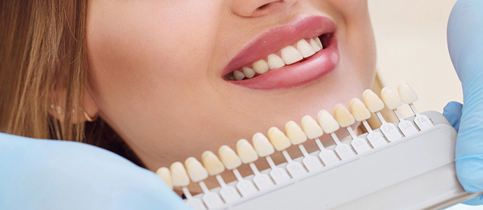 реставрация зубов по доступным ценам в клинике