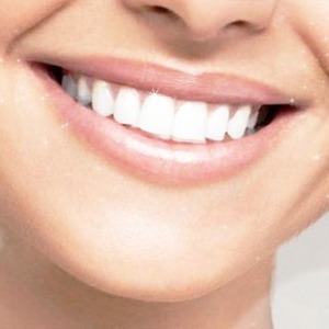 Гигиеническая чистка зубов Air Flow - скидка 30%